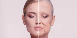 Fights Premature skin ageing