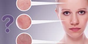 TAKING A SKIN TYPE QUIZ