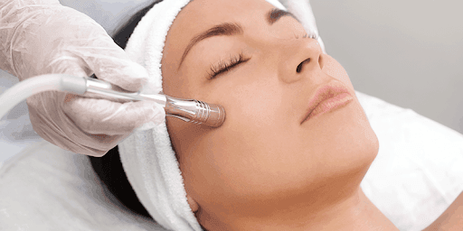 Microdermabrasion 
