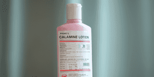 . Keep a Calamine Lotion Handy