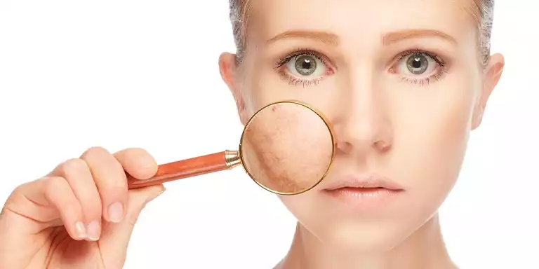 Treating Pigmentation