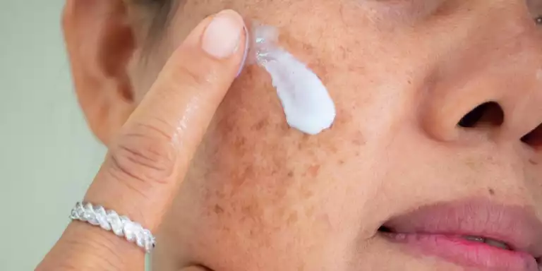 Different Types Of Pigmentation