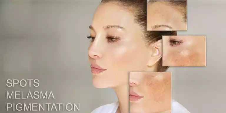 Causes of Skin Pigmentation