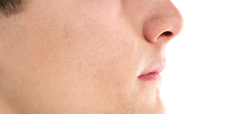 face clean up before the festive season