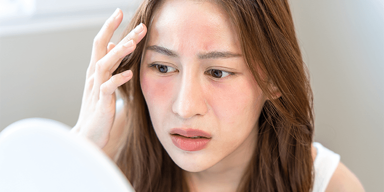 Soothes Inflammation and Sunburn