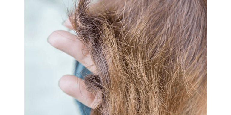 Reverse Damage Due To Exposure To Sun